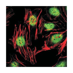 ZBTB16, Mouse, Clone: 5B3, Abnova 100&mu;L; Unlabeled:Antibodies, Monoclonal