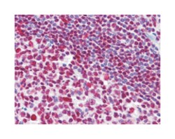 MDM4, Mouse, Clone: 2D10F4, Abnova 100&mu;L; Unlabeled:Antibodies, Monoclonal