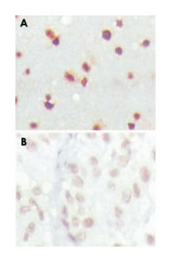 MDM4, Mouse, Clone: 2D10F4, Abnova 100&mu;L; Unlabeled:Antibodies, Monoclonal
