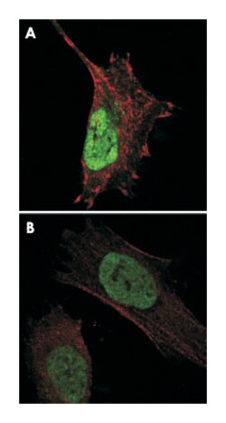 MDM4, Mouse, Clone: 2D10F4, Abnova 100&mu;L; Unlabeled:Antibodies, Monoclonal