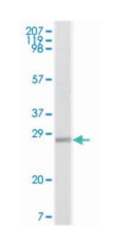 S100A1, Mouse, Clone: 2C8B8, 2C8E8, 3C8D8, Abnova 100&mu;L; Unlabeled:Antibodies,