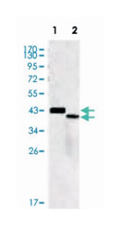 SORL1, Mouse, Clone: 7D7B11, Abnova 100&mu;L; Unlabeled:Antibodies, Monoclonal