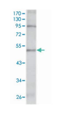 TBX5, Mouse, Clone: 7B11, Abnova 100&mu;L; Unlabeled:Antibodies, Monoclonal