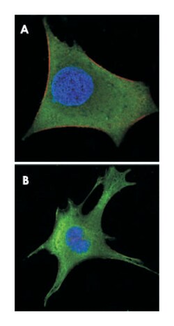 WNT1, Mouse, Clone: 10C8, Abnova 100&mu;L; Unlabeled:Antibodies, Monoclonal