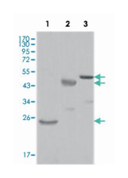 KARS, Mouse, Clone: 8G12C1, Abnova 100&mu;L; Unlabeled:Antibodies, Monoclonal