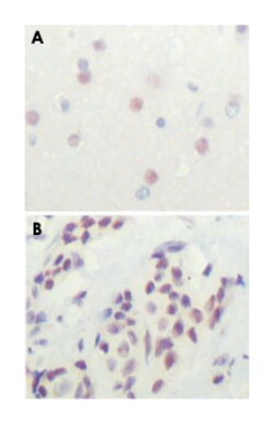 NCOR1, Mouse, Clone: 7A7A9, Abnova 100&mu;L; Unlabeled:Antibodies, Monoclonal