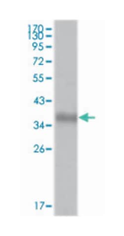 NCOR1, Mouse, Clone: 7A7A9, Abnova 100&mu;L; Unlabeled:Antibodies, Monoclonal