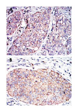 SERPINE1, Mouse, Clone: 1D5, Abnova 100&mu;L; Unlabeled:Antibodies, Monoclonal