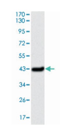 SERPINE1, Mouse, Clone: 1D5, Abnova 100&mu;L; Unlabeled:Antibodies, Monoclonal