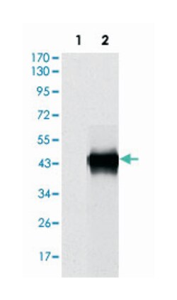 SERPINE1, Mouse, Clone: 1D5, Abnova 100&mu;L; Unlabeled:Antibodies, Monoclonal