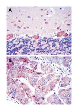 SMAD2, Mouse, Clone: 5G7, Abnova 100&mu;L; Unlabeled:Antibodies, Monoclonal