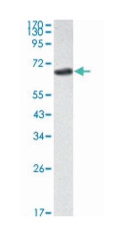 SMAD2, Mouse, Clone: 5G7, Abnova 100&mu;L; Unlabeled:Antibodies, Monoclonal