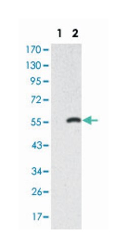 SMAD2, Mouse, Clone: 5G7, Abnova 100&mu;L; Unlabeled:Antibodies, Monoclonal