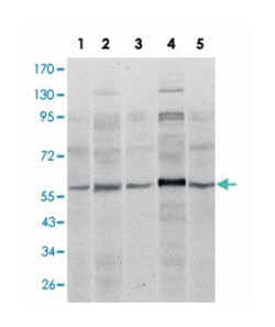 SMAD4, Mouse, Clone: 4G1C6, Abnova 100&mu;L; Unlabeled:Antibodies, Monoclonal