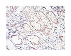 SMAD4, Mouse, Clone: 4G1C6, Abnova 100&mu;L; Unlabeled:Antibodies, Monoclonal