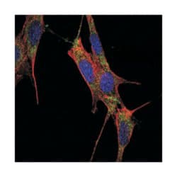 SMAD4, Mouse, Clone: 4G1C6, Abnova 100&mu;L; Unlabeled:Antibodies, Monoclonal