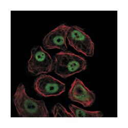 SMC1A, Mouse, Clone: 5B6, Abnova 100&mu;L; Unlabeled:Antibodies, Monoclonal
