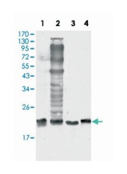 SOD1, Mouse, Clone: 6F5, Abnova 100&mu;L; Unlabeled:Anticuerpos