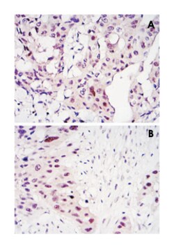 STAT3, Mouse, Clone: 3B5, Abnova 100&mu;L; Unlabeled:Antibodies, Monoclonal