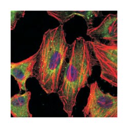 STAT3, Mouse, Clone: 3B5, Abnova 100&mu;L; Unlabeled:Antibodies, Monoclonal