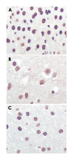CDKN2A, Mouse, Clone: 2D9A12, Abnova 100 &mu;L | Buy Online | Abnova | Fisher Scientific