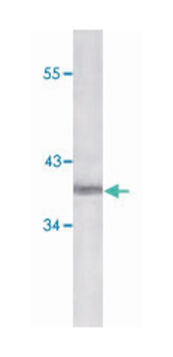 CDKN2A, Mouse, Clone: 2D9A12, Abnova 100 &mu;L | Buy Online | Abnova | Fisher Scientific