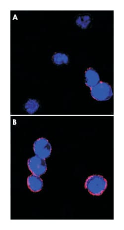 ITGB2, Mouse, Clone: 10E12, Abnova 100&mu;L; Unlabeled:Antibodies, Monoclonal