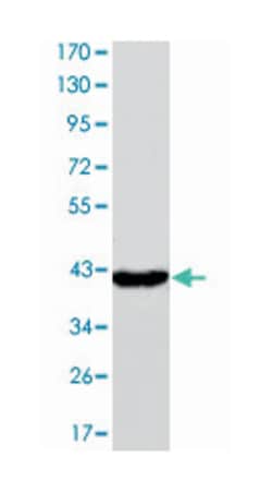 FABP4, Mouse, Clone: 9B8D, Abnova 100&mu;L; Unlabeled:Antibodies, Monoclonal