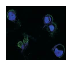 FGFR4, Mouse, Clone: 7H1, Abnova 100&mu;L; Unlabeled:Antibodies, Monoclonal