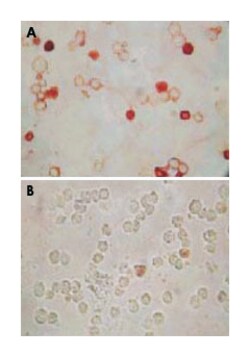 ORF62, Mouse, Clone: 5B7B6, Abnova 100 &mu;L | Buy Online | Abnova Corporation | Fisher Scientific
