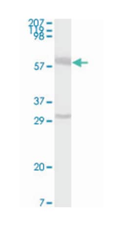 ESR1, Mouse, Clone: 2B7, Abnova 100&mu;g; Unlabeled:Antibodies, Monoclonal