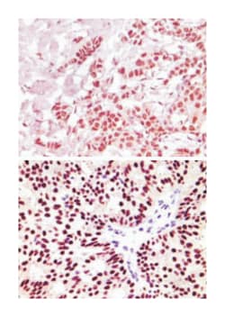 ESR1, Mouse, Clone: 2B7, Abnova 100&mu;g; Unlabeled:Antibodies, Monoclonal