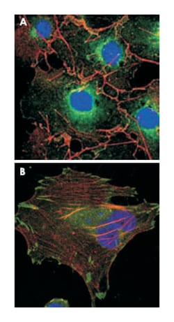 LPP, Mouse, Clone: 8B3A11, Abnova 100&mu;L; Unlabeled:Antibodies, Monoclonal