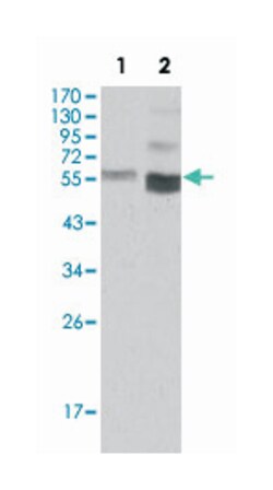 PTEN, Mouse, Clone: 1B8, Abnova 100&mu;L; Unlabeled:Antibodies, Monoclonal