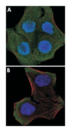 PTEN, Mouse, Clone: 1B8, Abnova 100&mu;L; Unlabeled:Antibodies, Monoclonal