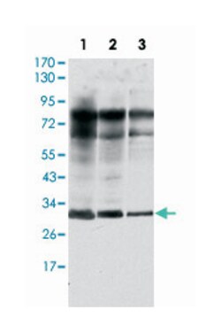 RAB25, Mouse, Clone: 3F12, Abnova 100&mu;L; Unlabeled:Antibodies, Monoclonal