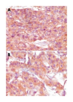 SRA1, Mouse, Clone: 1D4H8, Abnova 100&mu;L; Unlabeled:Antibodies, Monoclonal