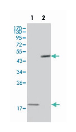BIRC5, Mouse, Clone: 2H5H2, Abnova 100&mu;L; Unlabeled:Antibodies, Monoclonal