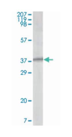 ORF62, Mouse, Clone: 5B7B6, Abnova 100 &mu;L | Buy Online | Abnova Corporation | Fisher Scientific