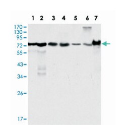 LPP, Mouse, Clone: 8B3A11, Abnova 100&mu;L; Unlabeled:Antibodies, Monoclonal