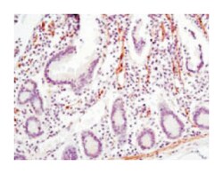 LPP, Mouse, Clone: 8B3A11, Abnova 100&mu;L; Unlabeled:Antibodies, Monoclonal
