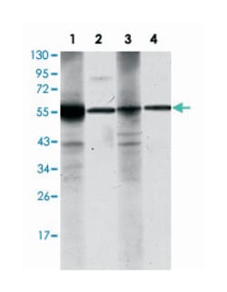 ALDH1A1, Mouse, Clone: 5A11, Abnova 100&mu;L; Unlabeled:Antibodies, Monoclonal