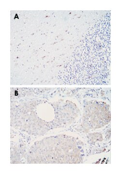 ALDH1A1, Mouse, Clone: 5A11, Abnova 100&mu;L; Unlabeled:Antibodies, Monoclonal