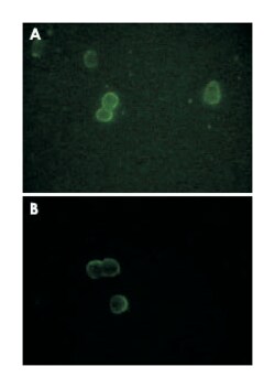 APOM, Mouse, Clone: 10C3G5, Abnova 100&mu;g; Unlabeled:Antibodies, Monoclonal