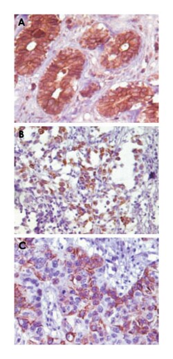 BLK, Mouse, Clone: 9D10B7, Abnova 100 &mu;L | Buy Online | Abnova | Fisher Scientific