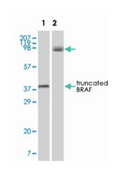 BRAF, Mouse, Clone: 1H12F1, 1H12G10, 1F12F11C9, Abnova 100&mu;L; Unlabeled:Antibodies,
