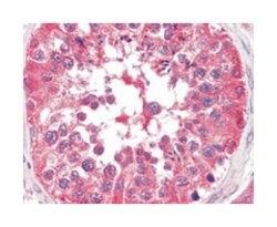 BRAF, Mouse, Clone: 1H12F1, 1H12G10, 1F12F11C9, Abnova 100&mu;L; Unlabeled:Antibodies,