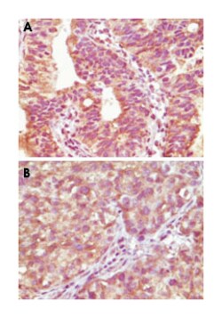 BRAF, Mouse, Clone: 1H12F1, 1H12G10, 1F12F11C9, Abnova 100&mu;L; Unlabeled:Antibodies,