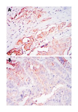 CEACAM5, Mouse, Clone: 1C7, Abnova 100&mu;L; Unlabeled:Antibodies, Monoclonal