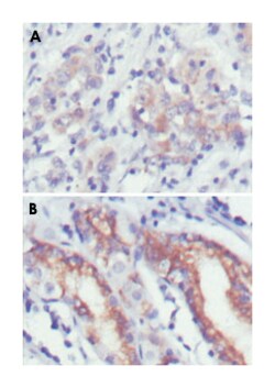 CER1, Mouse, Clone: 9D6, Abnova 100&mu;L; Unlabeled:Antibodies, Monoclonal